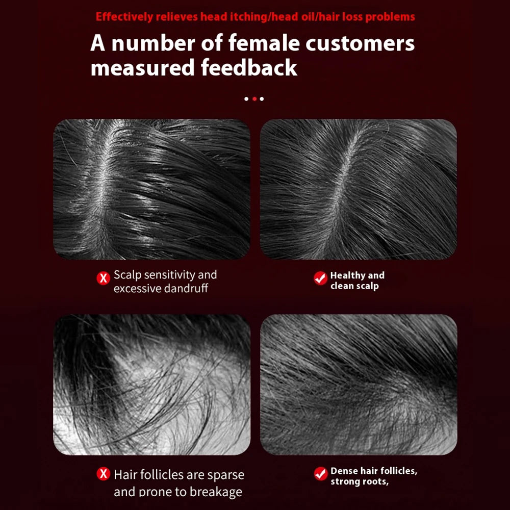 For You™ Electric Massage Comb