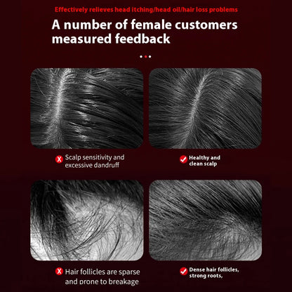 For You™ Electric Massage Comb